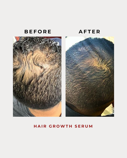 Hair Growth Serum 15G