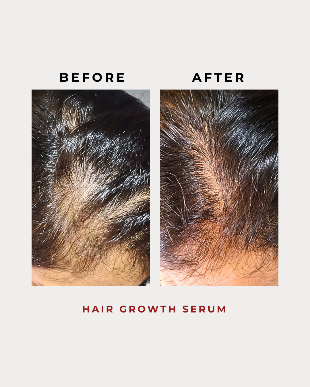 Hair Growth Serum 15G