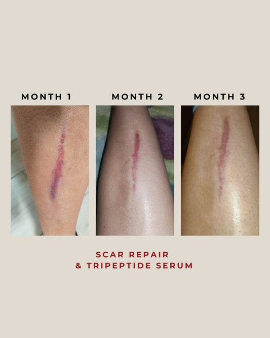 Scar Repair & Tri-Peptide 30g