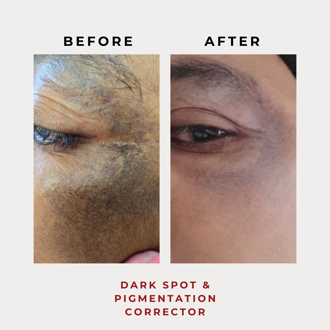 Dark Spot & Pigmentation Corrector 30g