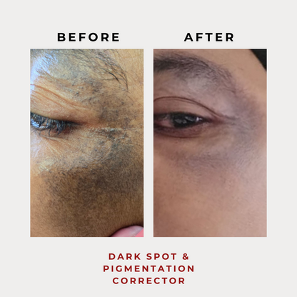 Dark Spot & Pigmentation Corrector 30g