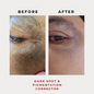 Dark Spot & Pigmentation Corrector 30g