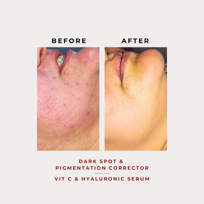 Vit C + Hyaluronic Acid 30G